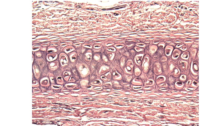 <p>Identify the connective tissue below.</p>