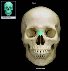 <p>Name this bone.</p>