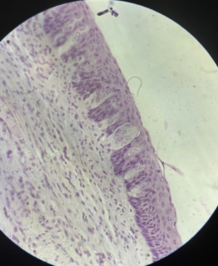 <p>Contains Supportive Cell and Sensory Cells within the epithelium.</p>