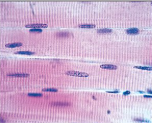 <p>What muscle is this?</p>