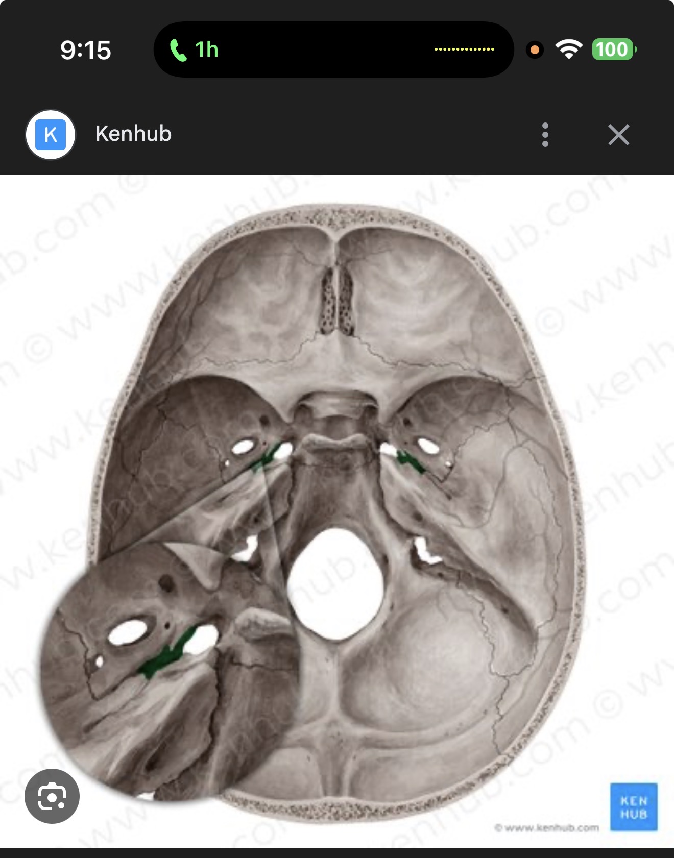 <p>what is this? R/L</p>