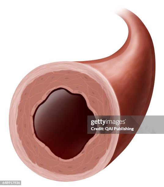 <p>Vasoconstriction</p>