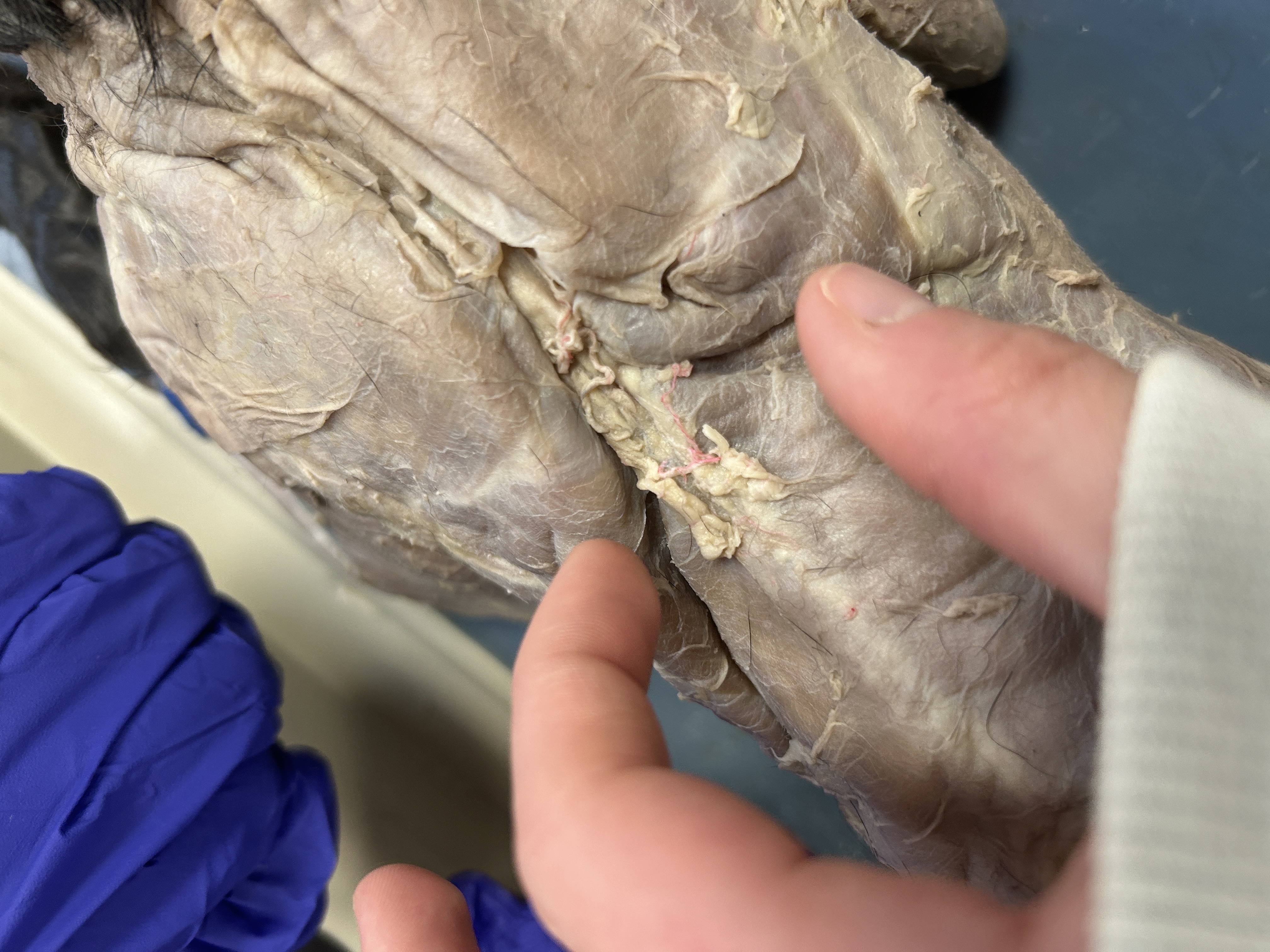 <p>Spinotrapezius(triangle on back)</p>