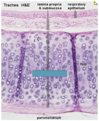 <p>Identify the type of cartilage</p>