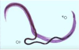 <ul><li><p>adult form of schitosoma </p></li><li><p>causes schistosomiasis (snail fever)</p></li></ul><p></p>