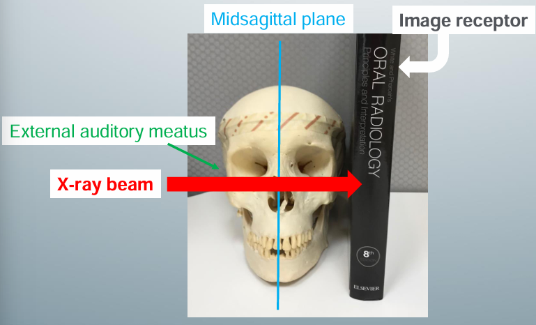 <p>-image receptor parallels the patient’s midsagittal plane</p><p>-central x-ray beam centered over the external auditory meatus</p>