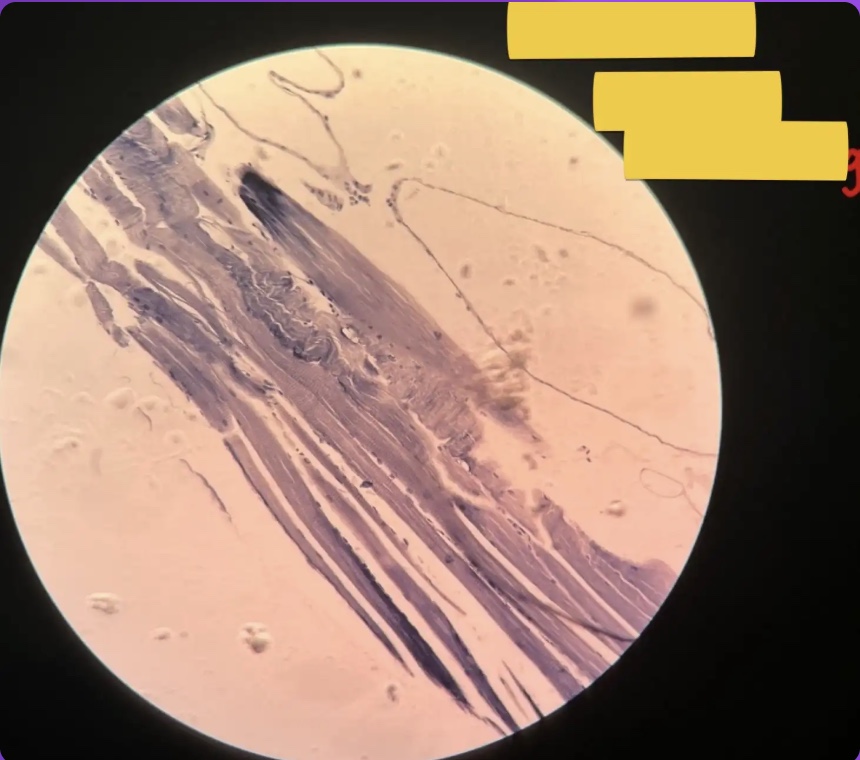 <p>What does the yellow box represent?</p>