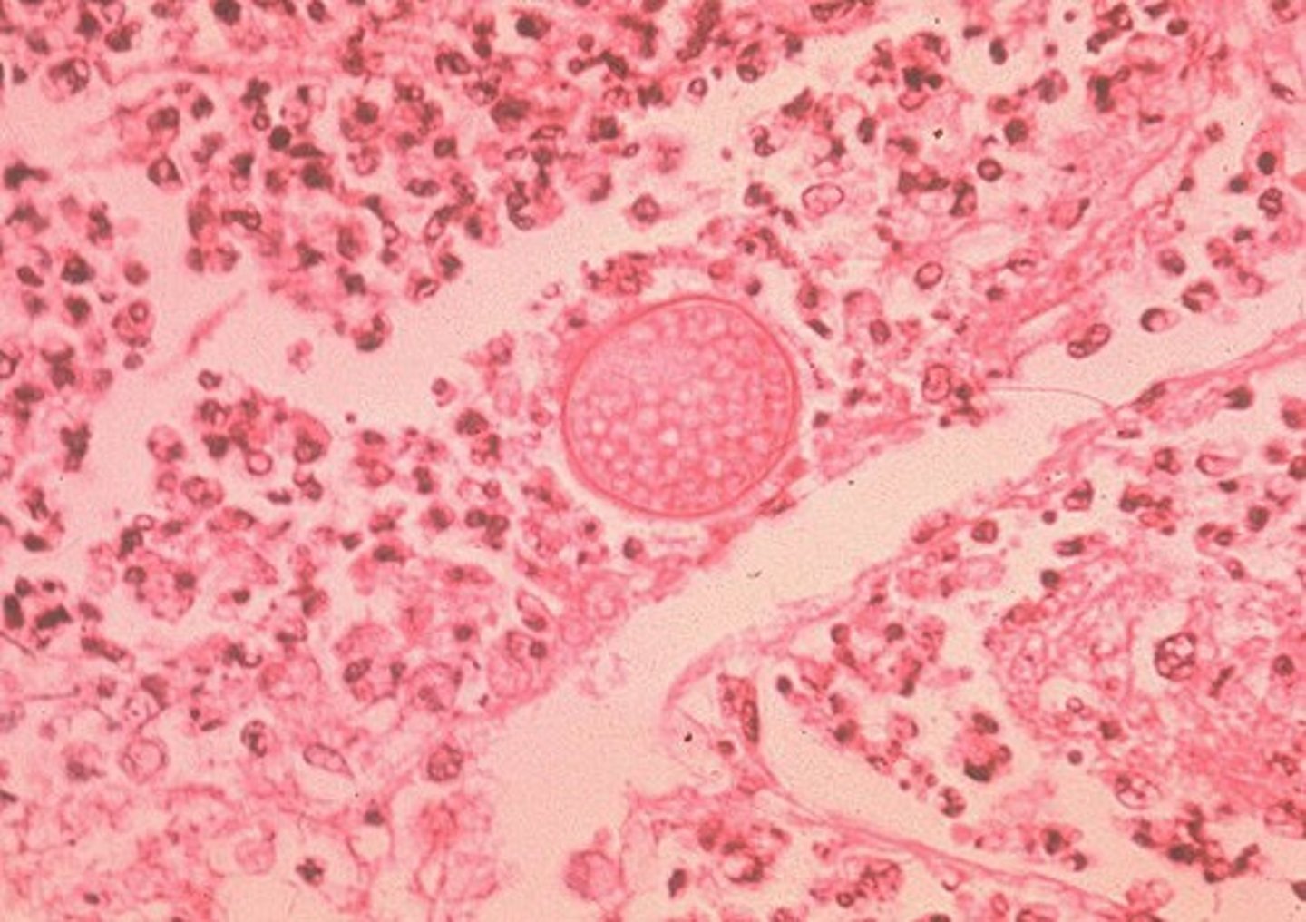 <p>Round, refractive spherules filled with endospores</p>