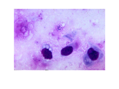 <p>mast cells or H. pylori</p>