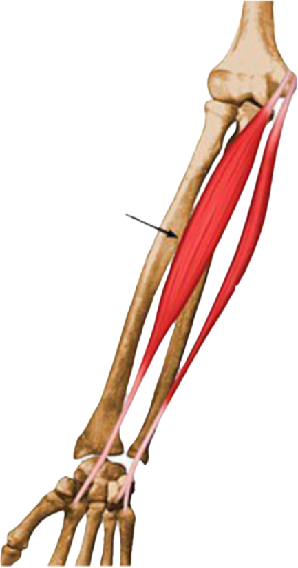 <p>What muscle is being shown? </p>