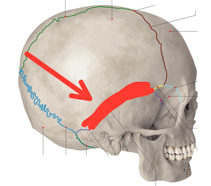 term image