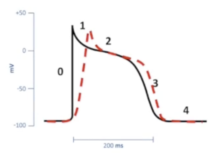 <p>Divided into three subclasses:</p><ul><li><p><strong>Class IA: moderate influence on phase 0</strong></p></li><li><p>Slow conduction velocity</p></li><li><p>Prolong repolarization</p></li><li><p>Extend AP duration</p></li><li><p>Procainamide, quinidine, disopyramide</p></li><li><p>Risk of Torsades de Pointes, GI upset, enhanced AV conduction, hypotension</p></li></ul><p></p><ul><li><p><strong>Class IB: weak influence on phase 0</strong></p></li><li><p>Little impact on conduction velocity</p></li><li><p>Shorten repolarization</p></li><li><p>Decrease AP duration</p></li><li><p>Lidocaine, mexiletine, phenytoin, tocainide</p></li></ul><p></p><p><strong>Class IC: strong influence on phase 0</strong></p><ul><li><p>Repolarization unchanged</p></li><li><p>No effect on AP duration</p></li><li><p>Slow conduction to break or prevent arrhythmias</p></li><li><p>Flecainide, propafenone, encainide, moricizine</p></li></ul><p></p>