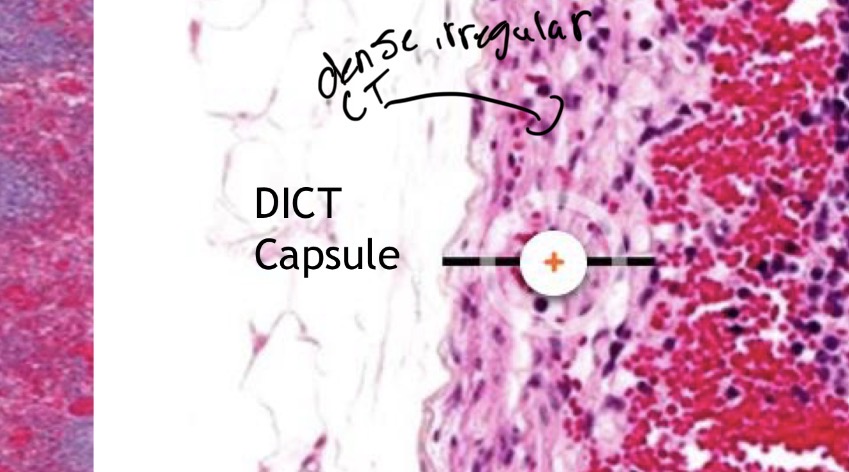<p>thick collagenous fibers</p><p>arranged into random orientations</p><p>majority of cells are fibrobalst</p><p>found in GI tract (ileum) and hemal node</p>