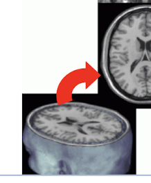 <p>What is this view of the brain?</p>