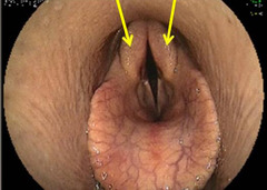 <p>Is this normal or abnormal? What is happening?</p>