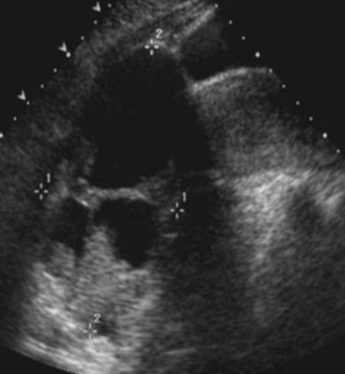 term image