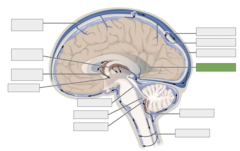 <p>This is the</p>