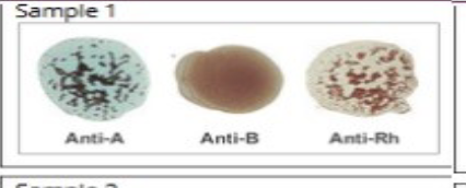 <p>What blood type is this?</p>