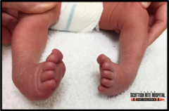<p>CC: pain and callus formation along lateral border of foot</p><p>Brought in by primary caregiver</p>
