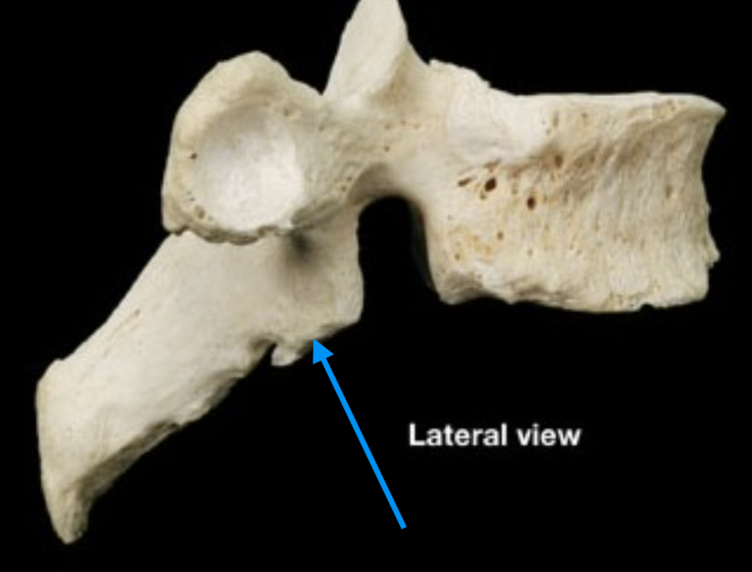 <p>Identify the structure of a typical vertebra.</p>