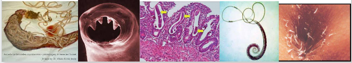 <p>- Ascaris lumbricoides - 1 billion infected, ~ 3,000 deaths/yr - Hookworms- Ancyclostoma duadenale and Necator americanus. ~700 million infected, 22 million DALYs lost</p><p>- Trichuris trichura - whipworm, 600 million infected</p><p>- Strongyloides stercolis- Only free living helminth</p><p>- Enterobius vermicularis - Pinworm, global occurrence, common infection in children (pruritus - itchy bum)</p>