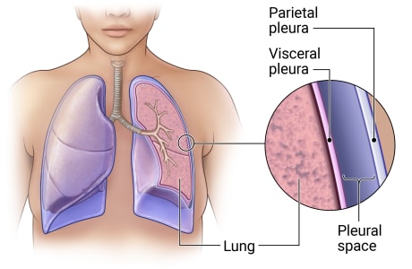 <p>inner layer; adheres lungs, outer layer; attaches to thoracic wall and diaphragm, space between the two layers which is very small as the two layers are together and it technically contains pleural fluid</p>