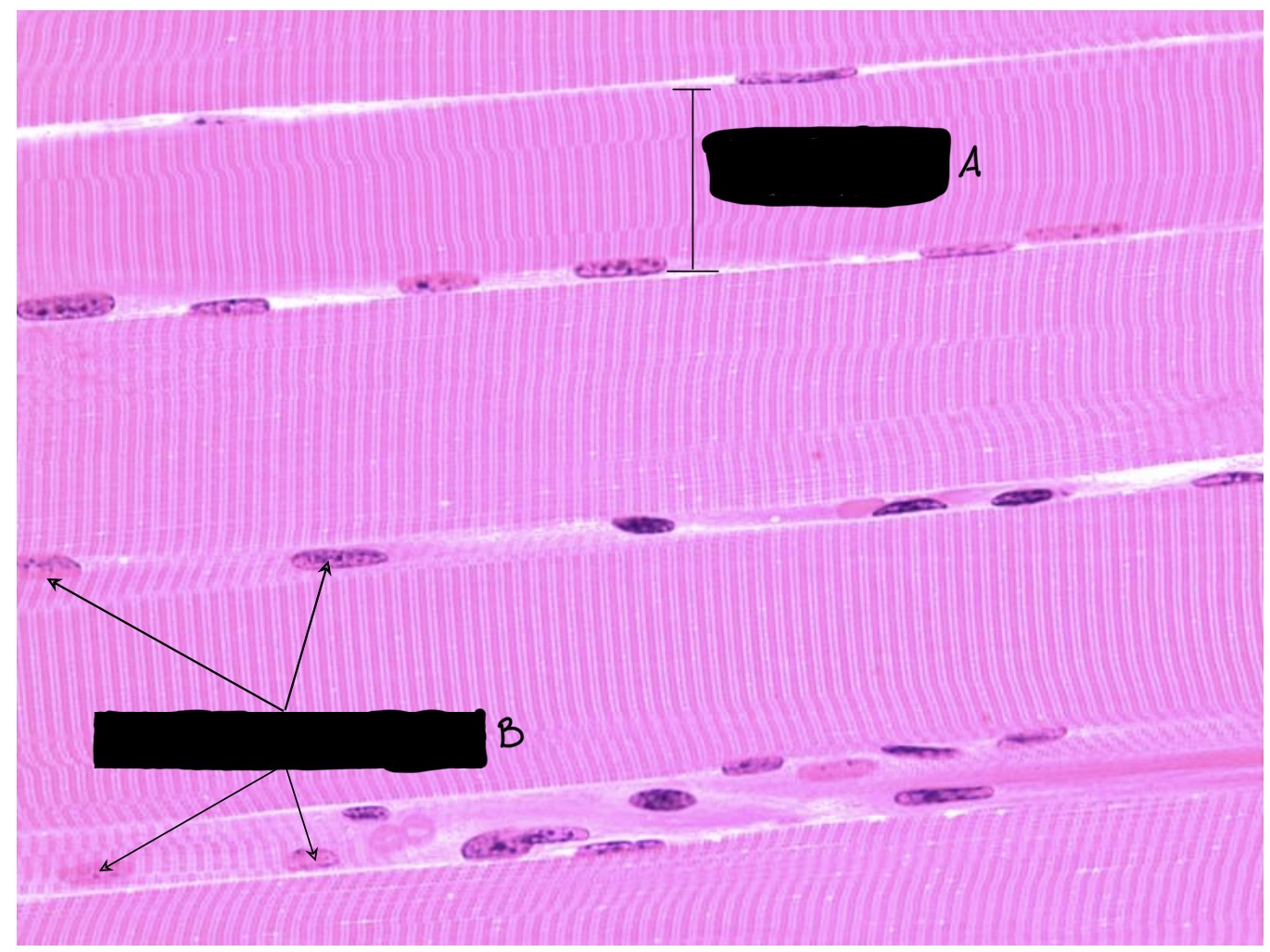 <p>What kind of muscle tissue is this? Label. Where is it found in the body?</p>