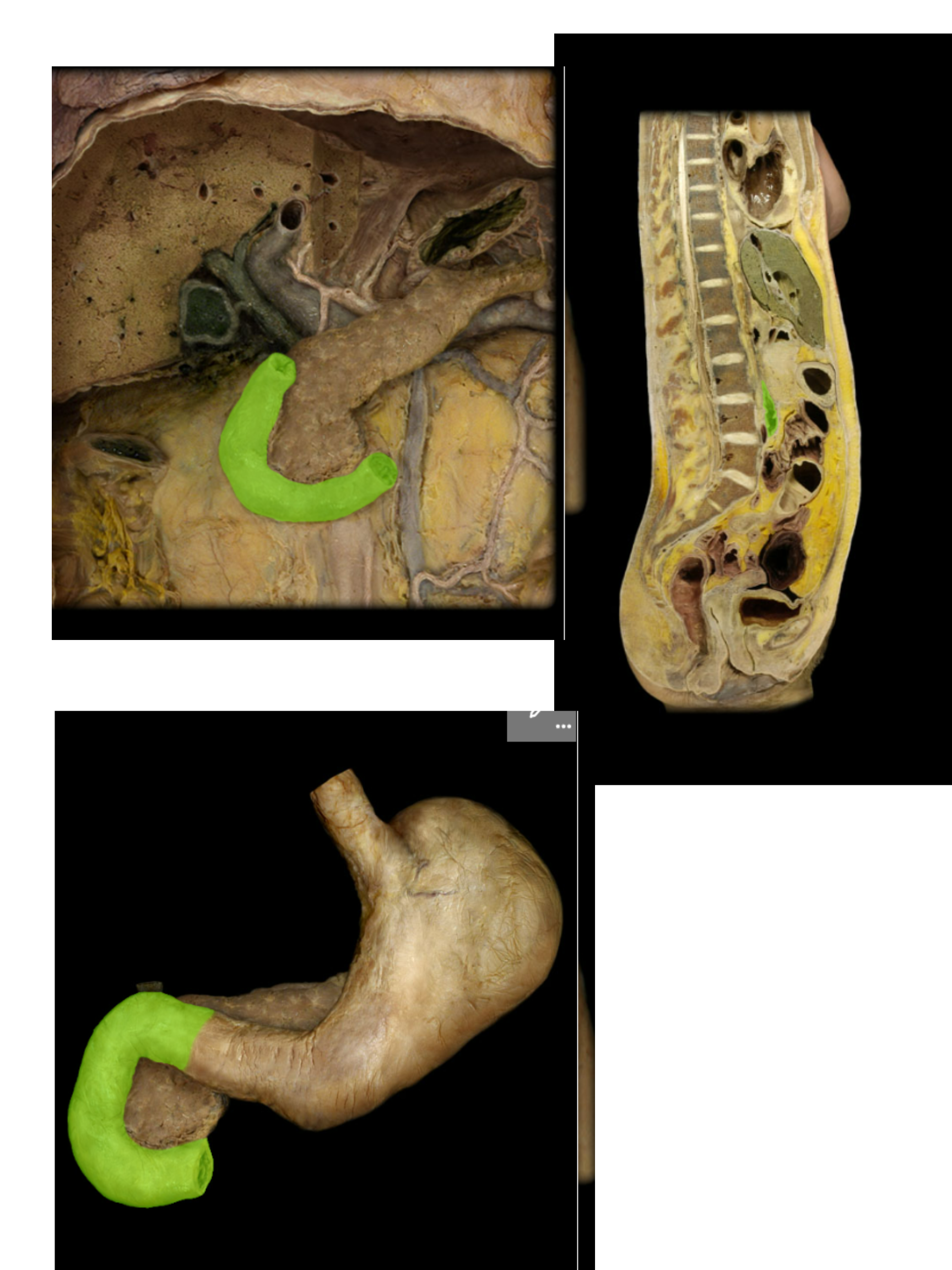 <p><span>Duodenum</span></p>