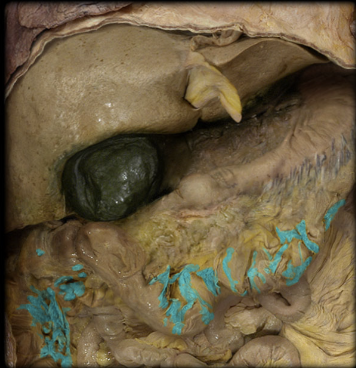 term image