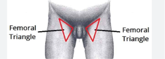 <p>is found on the sides near the groin</p>