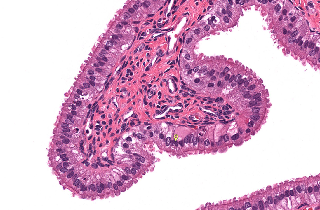 term image