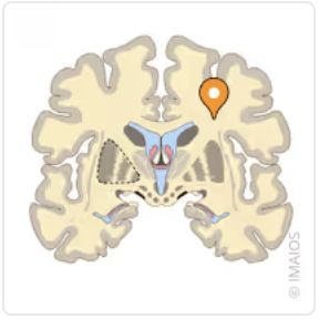 <p>Name the major white matter tract</p>