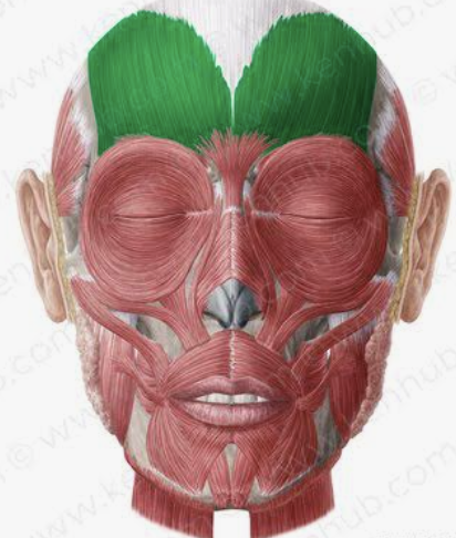 <p>Which muscle is this?</p>