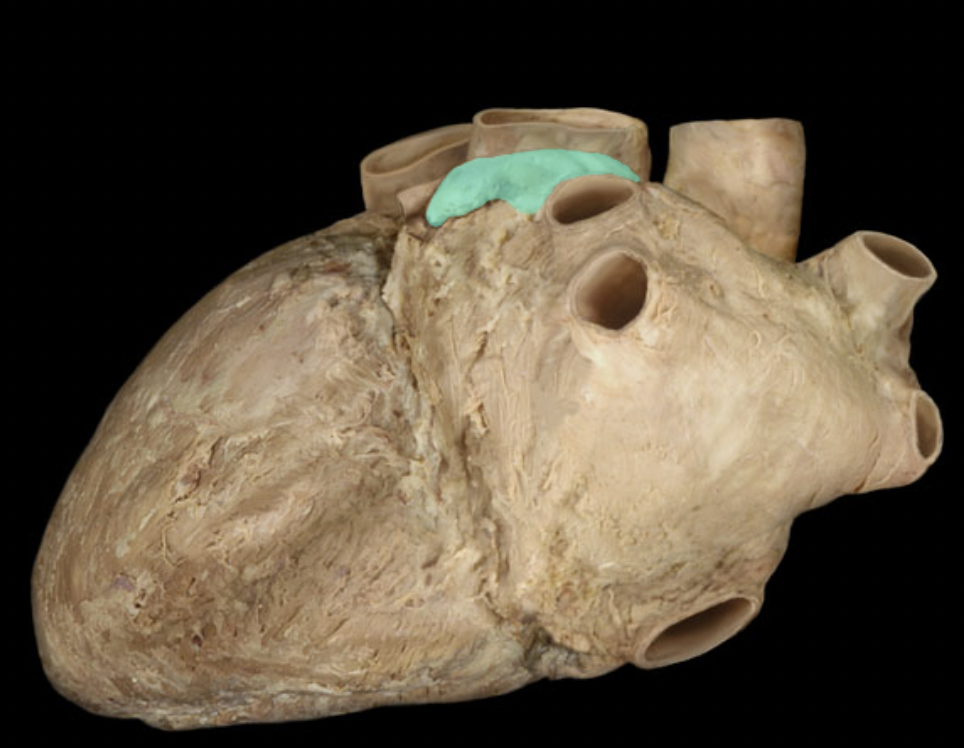 <p>Identify the feature of the left atrium</p>