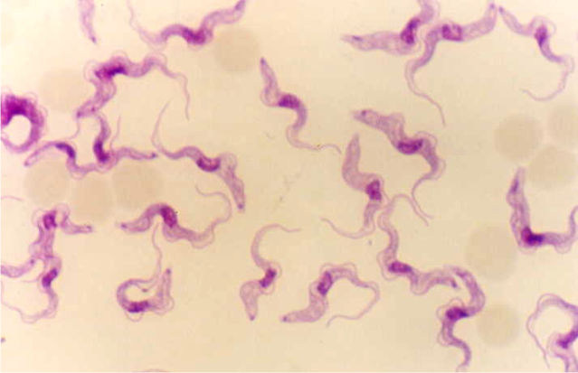 <p>East African sleeping sickness?</p>