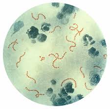 <p><span>gram + cocci (aligned in chains or pairs)</span></p>