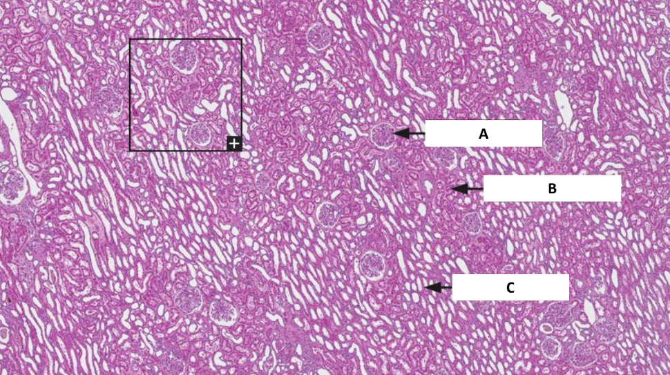 <p>Name the structure indicated by C.</p>