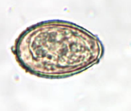 <p>What parasite is this?</p>