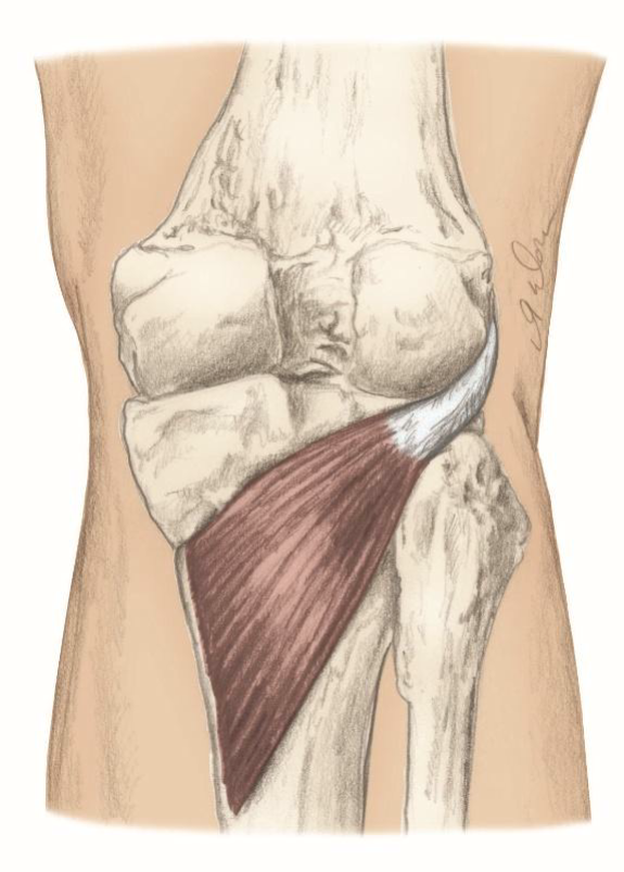 <p>Action:  Medially roate flexed knee, Flex the knee</p><p>Origin: Lateral condyle of the femur</p><p>Insertion: Proximal posterior aspect of the tibia</p><p></p>