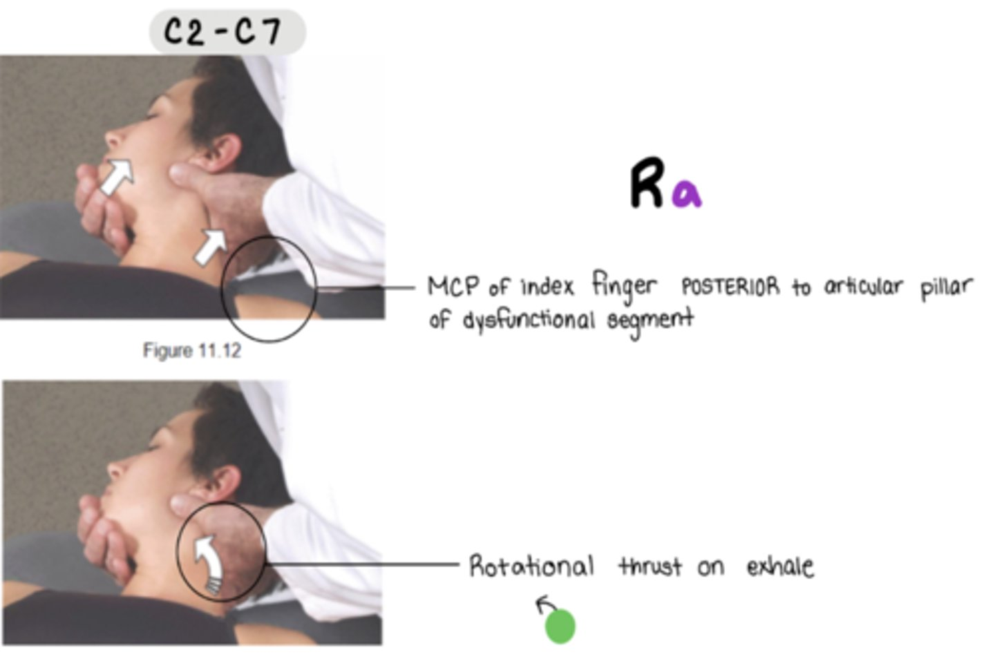 <p>Ra</p><p>stand on SAME side of dysfunctional rotation component</p><p>MCP of index finger POSTERIOR to articular pillar of dysfunctional segment</p><p>**must lock out</p><p>can slightly flex to point and also side bend towards to initiate lockout</p><p>rotational thrust on exhale</p>