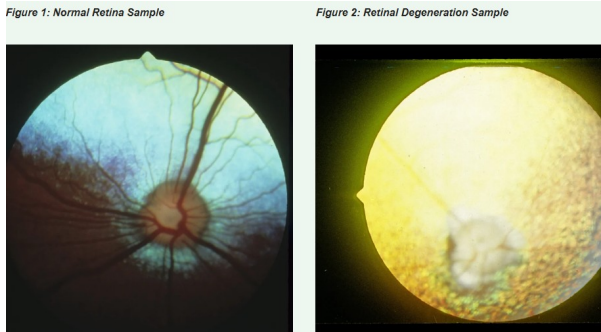 <p>Multiple types and genes:</p><ul><li><p>rcd4-PRA</p></li><li><p>NECAP1</p></li></ul><p></p>