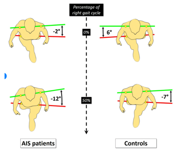 <p>Determinants of gait </p>