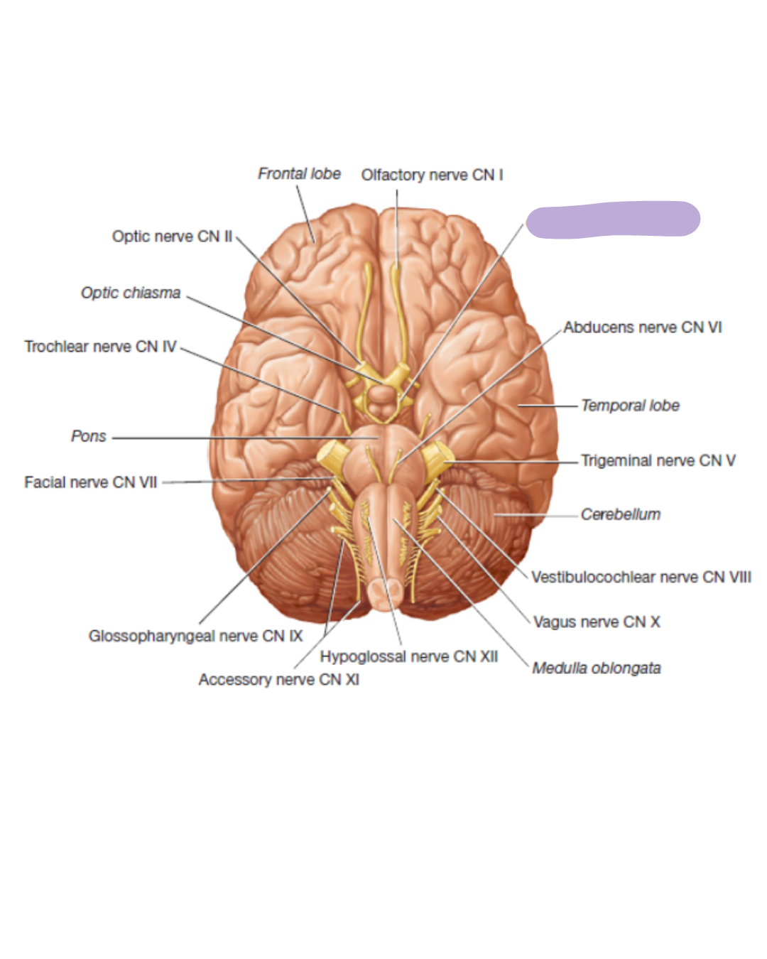 <p>find the CN III Oculomotor Nerve</p>