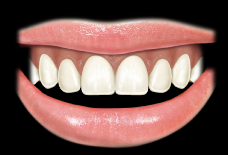 <ul><li><p>reveal and contiguous band of gingiva </p></li><li><p>reveal the total cervico-incisal length of the maxillary anterior teeth </p></li></ul><p></p>