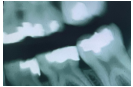 <p>Blurred image</p>