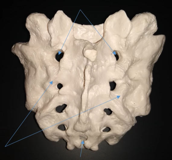 <p>What is the arrow at the bottom pointing at?</p>