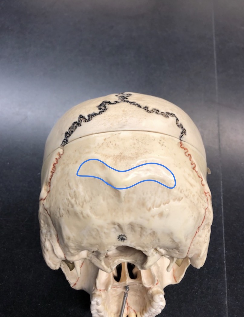 <p>what is the name of this <strong>STRUCTURE</strong>?</p>