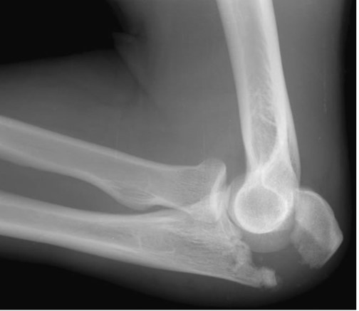 <p>What is the diagnosis?</p>