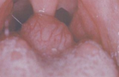 <ol start="27"><li><p>Identify the finding shown.</p></li></ol><p></p>