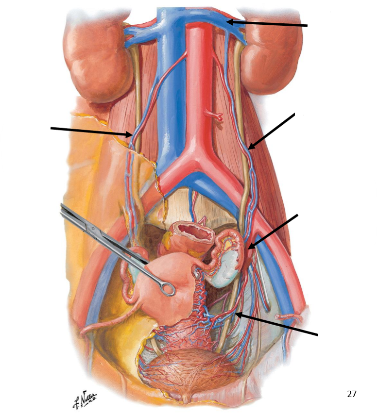 <p>Label the following diagram of the <strong>venous drainage</strong> of the female reproductive system</p>